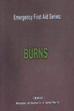 Movie Emergency First Aid Series: Burns